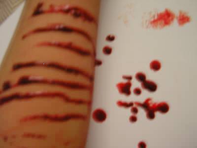 mutilation